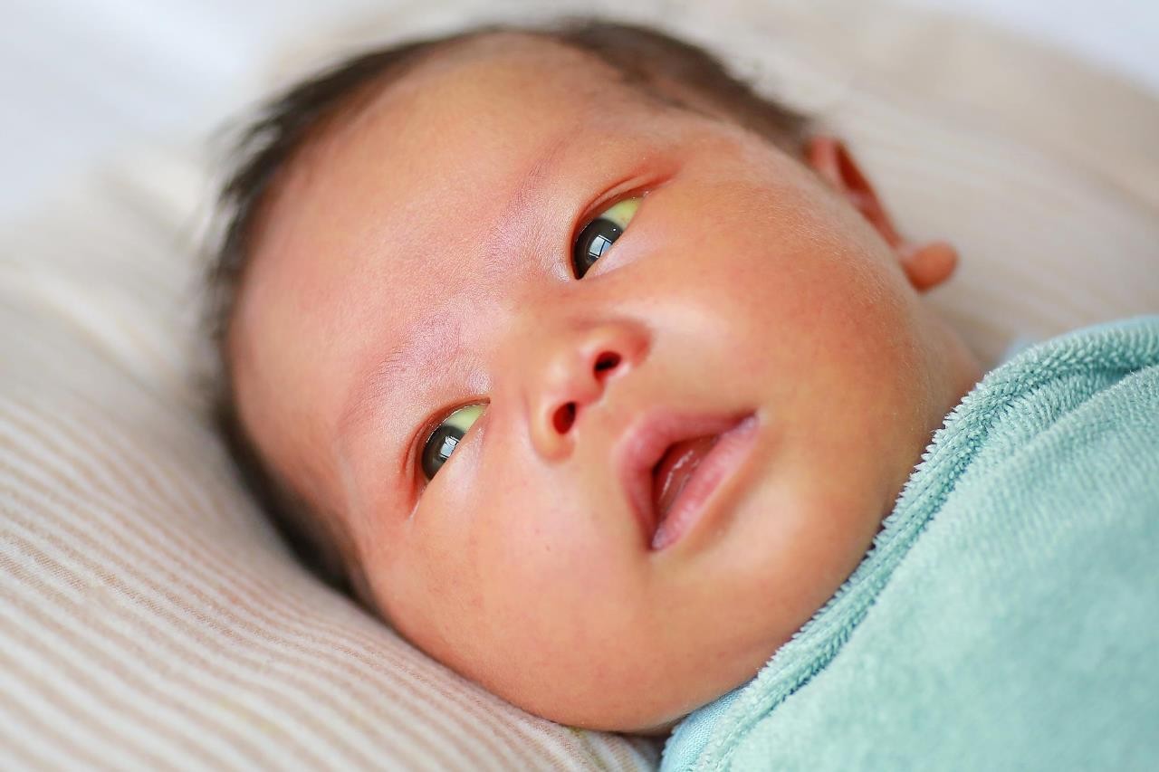 Em bé bị vàng da: Nguyên nhân, dấu hiệu và cách điều trị